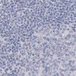 Myotilin Antibody in Immunohistochemistry (IHC)