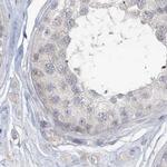 Myotilin Antibody in Immunohistochemistry (IHC)