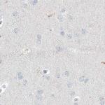 Myotilin Antibody in Immunohistochemistry (IHC)