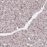 POLR2H Antibody in Immunohistochemistry (IHC)