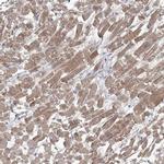 GBF1 Antibody in Immunohistochemistry (IHC)