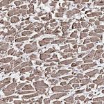 GBF1 Antibody in Immunohistochemistry (IHC)