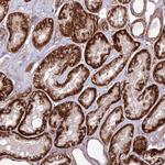 PSTK Antibody in Immunohistochemistry (Paraffin) (IHC (P))