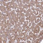 PSTK Antibody in Immunohistochemistry (Paraffin) (IHC (P))