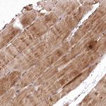 PSTK Antibody in Immunohistochemistry (Paraffin) (IHC (P))