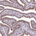 PSTK Antibody in Immunohistochemistry (Paraffin) (IHC (P))