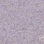 PSTK Antibody in Immunohistochemistry (Paraffin) (IHC (P))