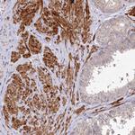 PSTK Antibody in Immunohistochemistry (Paraffin) (IHC (P))