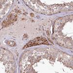 PSTK Antibody in Immunohistochemistry (Paraffin) (IHC (P))