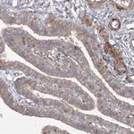 KBTBD4 Antibody in Immunohistochemistry (IHC)