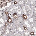 SNX18 Antibody in Immunohistochemistry (Paraffin) (IHC (P))