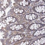 SNX18 Antibody in Immunohistochemistry (Paraffin) (IHC (P))