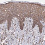 SNX18 Antibody in Immunohistochemistry (Paraffin) (IHC (P))