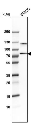 SNX18 Antibody in Western Blot (WB)