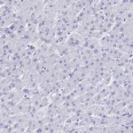 TNNT3 Antibody in Immunohistochemistry (Paraffin) (IHC (P))