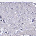 TNNT3 Antibody in Immunohistochemistry (IHC)