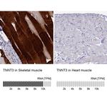 TNNT3 Antibody