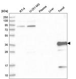 TNNT3 Antibody in Western Blot (WB)