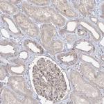 SYTL1 Antibody in Immunohistochemistry (IHC)