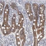 MTG1 Antibody in Immunohistochemistry (Paraffin) (IHC (P))