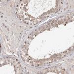 CDC123 Antibody in Immunohistochemistry (Paraffin) (IHC (P))