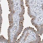 TRAF3IP1 Antibody in Immunohistochemistry (IHC)