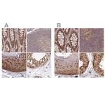 WAPL Antibody in Immunohistochemistry (IHC)