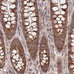 WAPL Antibody in Immunohistochemistry (IHC)