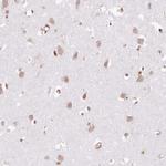 GCP2 Antibody in Immunohistochemistry (Paraffin) (IHC (P))