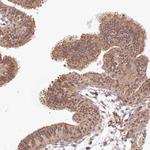 GCP2 Antibody in Immunohistochemistry (Paraffin) (IHC (P))