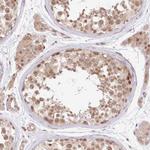 GCP2 Antibody in Immunohistochemistry (Paraffin) (IHC (P))