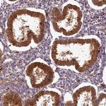 PPIP5K2 Antibody in Immunohistochemistry (Paraffin) (IHC (P))