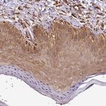 PPIP5K2 Antibody in Immunohistochemistry (Paraffin) (IHC (P))