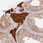 PPIP5K2 Antibody in Immunohistochemistry (Paraffin) (IHC (P))