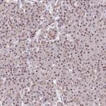 NSUN2 Antibody in Immunohistochemistry (IHC)