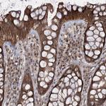 SERINC5 Antibody in Immunohistochemistry (IHC)