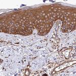 TAB182 Antibody in Immunohistochemistry (IHC)