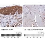 TAB182 Antibody