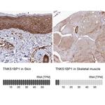 TAB182 Antibody in Immunohistochemistry (IHC)