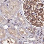 TAB182 Antibody in Immunohistochemistry (IHC)