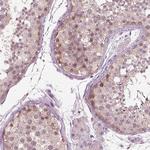 Shootin1 Antibody in Immunohistochemistry (Paraffin) (IHC (P))