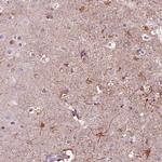 Shootin1 Antibody in Immunohistochemistry (IHC)