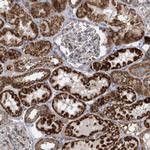 DHTKD1 Antibody in Immunohistochemistry (Paraffin) (IHC (P))