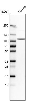 DHTKD1 Antibody in Western Blot (WB)