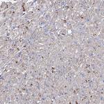 NRAP Antibody in Immunohistochemistry (Paraffin) (IHC (P))