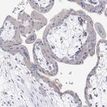 NRAP Antibody in Immunohistochemistry (Paraffin) (IHC (P))