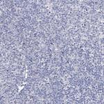 NRAP Antibody in Immunohistochemistry (Paraffin) (IHC (P))