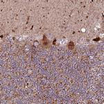 PHLDB1 Antibody in Immunohistochemistry (Paraffin) (IHC (P))