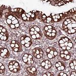 PHLDB1 Antibody in Immunohistochemistry (Paraffin) (IHC (P))