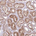 PHLDB1 Antibody in Immunohistochemistry (Paraffin) (IHC (P))